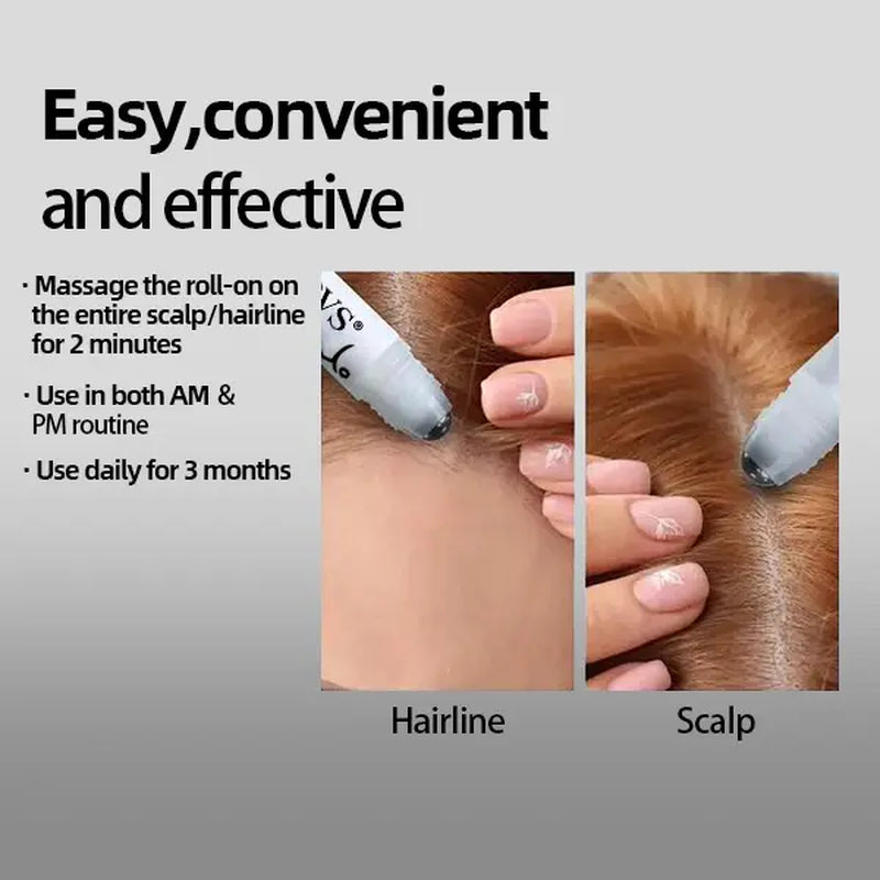 Rosemary Hair Growth Serum Roll on 25 Ml – 3% Rosemary, 3% Redensy, 2% Anagain , Scalp Serum, Boosts Oxygen Flow, Reduces Hair Fall