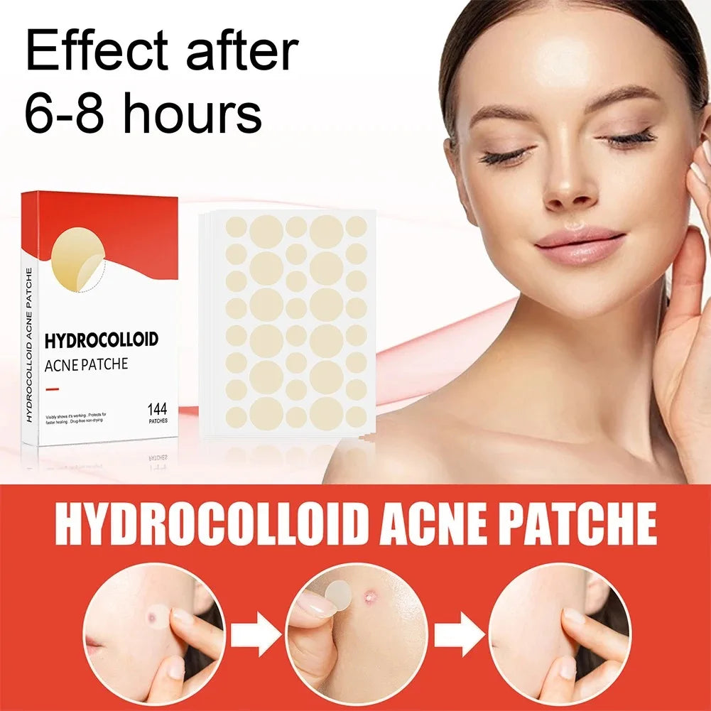 144Pcs/Set Face High-End Skin Care Pimple Acne Patches Professional Healing Absorbing Spot Sticker Covering for Covering Acne