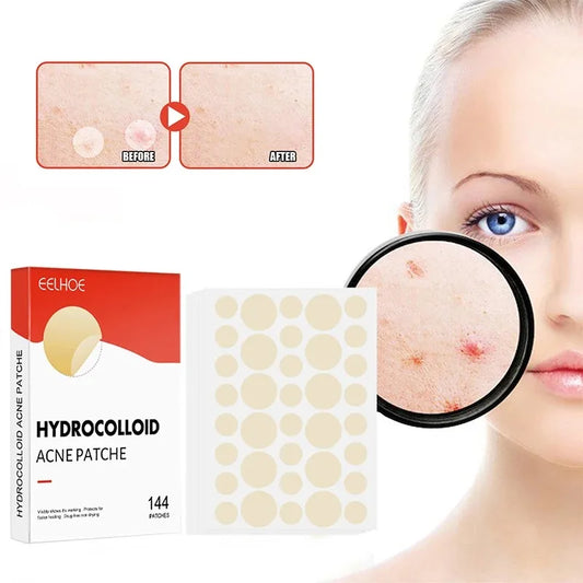 144Pcs/Set Face High-End Skin Care Pimple Acne Patches Professional Healing Absorbing Spot Sticker Covering for Covering Acne