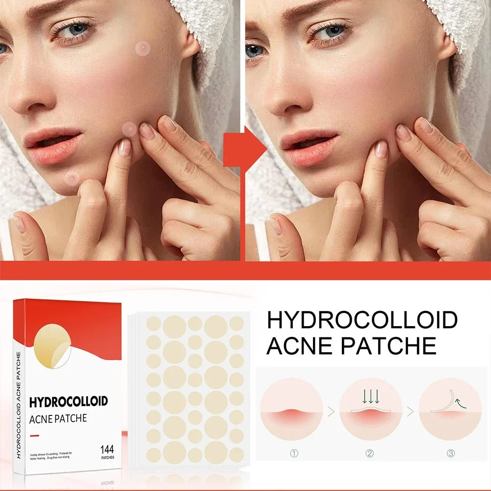 144Pcs/Set Face High-End Skin Care Pimple Acne Patches Professional Healing Absorbing Spot Sticker Covering for Covering Acne